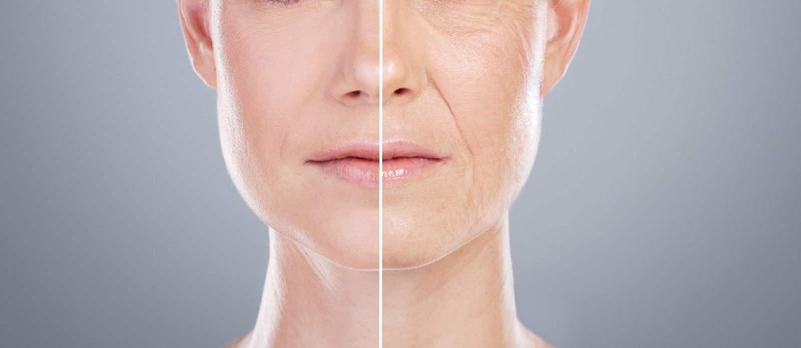 The Power of Prevention: How Anti-Wrinkle Injections Can Help